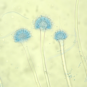 黴の顕微鏡写真（Aspergillus）